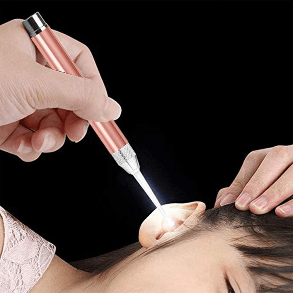 Pembersih Telinga Bayi Korek Kuping with Light - CMGF Pembersih Telinga Bayi Korek Kuping with Light - CG18 HRAPRG_ROSE_GOLD Pembersih Telinga Bayi Korek Kuping with Light - CMGF Pembersih Telinga Bayi Korek Kuping with Light - CG18 HRAPRG_ROSE_GOLD